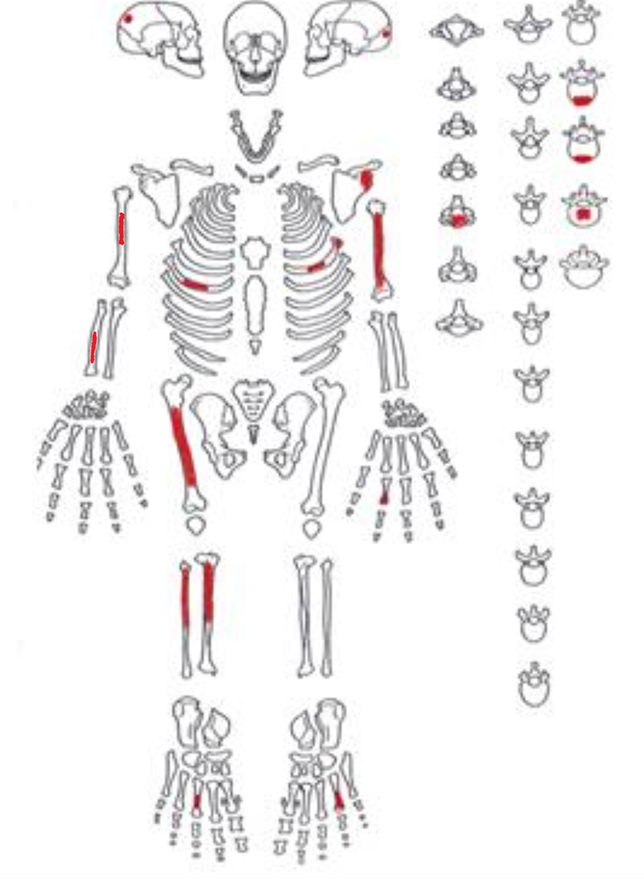 Ejemplo de una cédula osteológica de individuos adultos